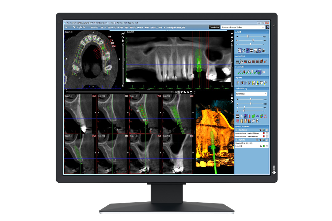 EIZO RadiForce MX217-HB